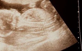 武汉第三代试管婴儿机构推荐